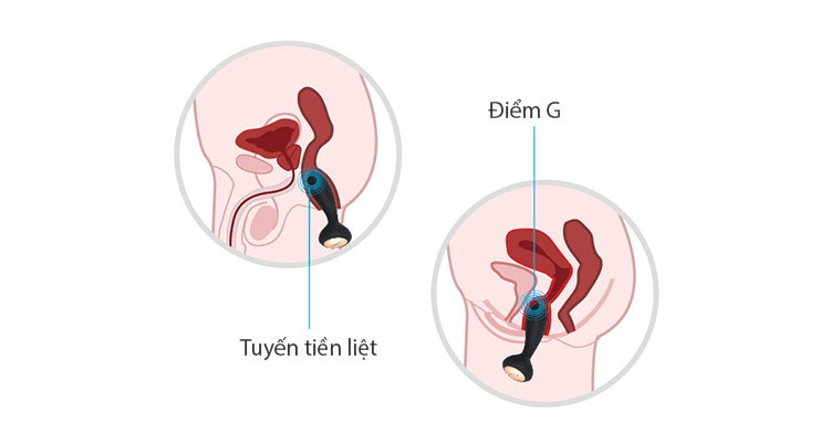 Máy rung Svakom Judy kích thích điểm G hậu môn cao cấp silicone