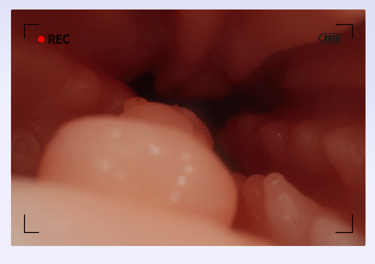 Búp bê tình dục bán thân Mizzzee Real Doll Sunny mũm mĩm xinh xắn