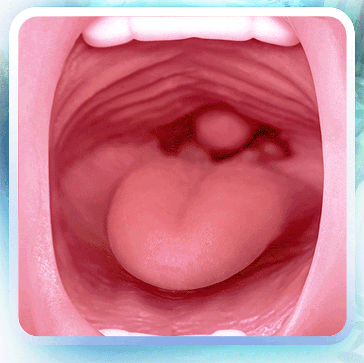 Miệng giả em gái nhỏ Aone LULU răng mềm mại, chân thực hàng đầu