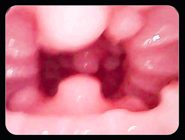 Mông giả nguyên khối Elfleda tròn mẩy 3.5kg rung lắc kích thích