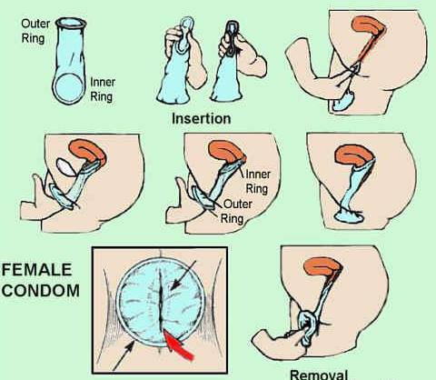 Ultra Thin Female Condom for Safe Intimacy Protection