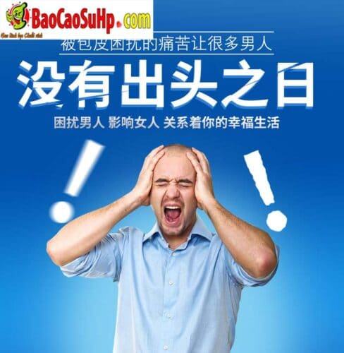 Bao cao su donden khúc giữa ForeSkin siêu mềm tăng khoái cảm