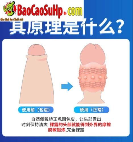 Bao cao su donden khúc giữa ForeSkin siêu mềm tăng khoái cảm