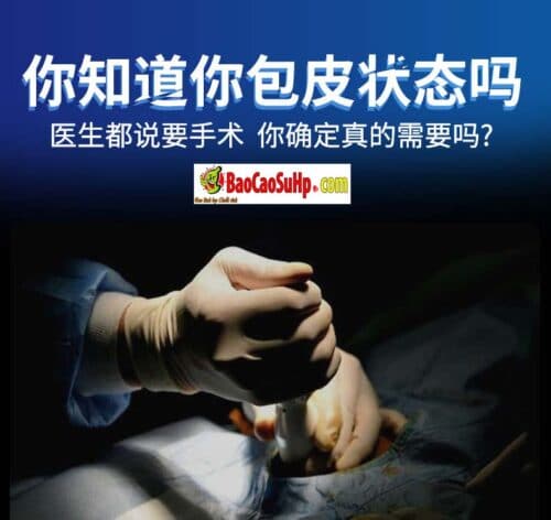 Bao cao su donden khúc giữa ForeSkin siêu mềm tăng khoái cảm