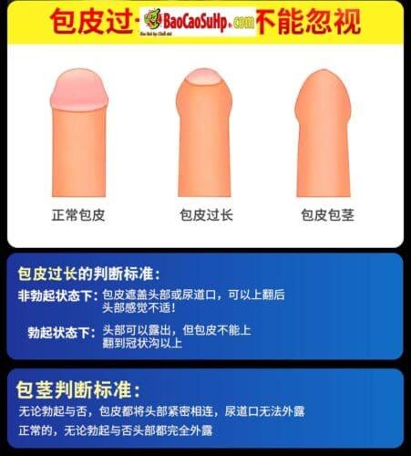 Bao cao su donden khúc giữa ForeSkin siêu mềm tăng khoái cảm