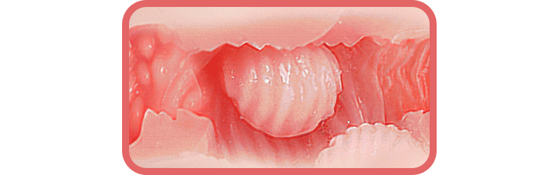 Âm Đạo Giả LETEN SUCKING 4 Rung Co Bóp Tự Nhiên Mạnh Mẽ