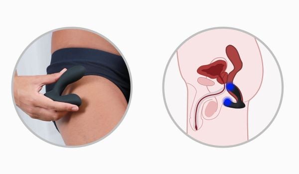 Máy massage tuyến tiền liệt SVAKOM Vick Neo