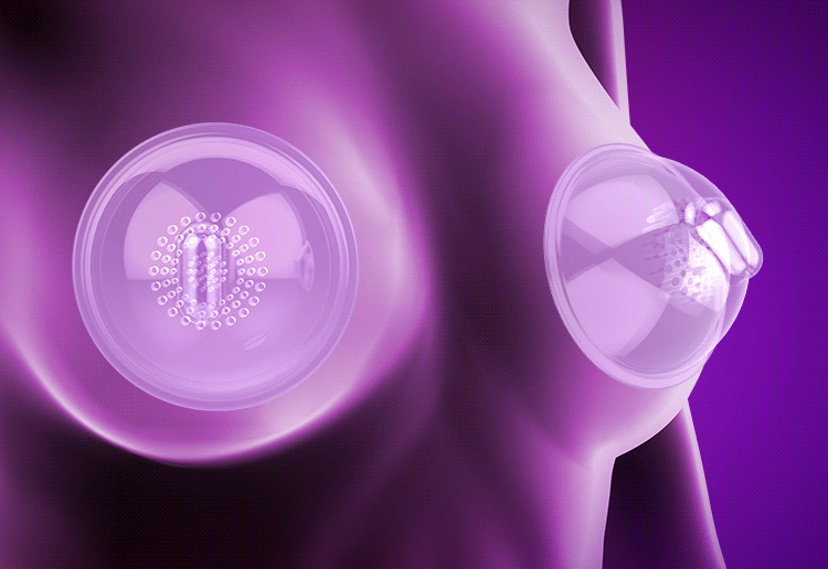 Máy massage nở ngực Leten DC67T silicon y tế an toàn hiệu quả Máy massage nở ngực Leten DC67T silicon y tế an toàn hiệu quả