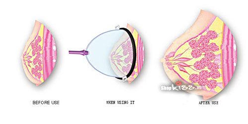 UHF Nipple Stimulator Breast Massager Female Intimate Toy