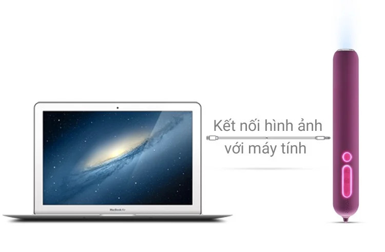 Máy rung Svakom Siime đa năng Camera nội soi kích thích mạnh mẽ