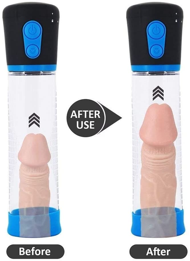 Máy bơm hút tự động tăng kích thước dương vật hiệu quả