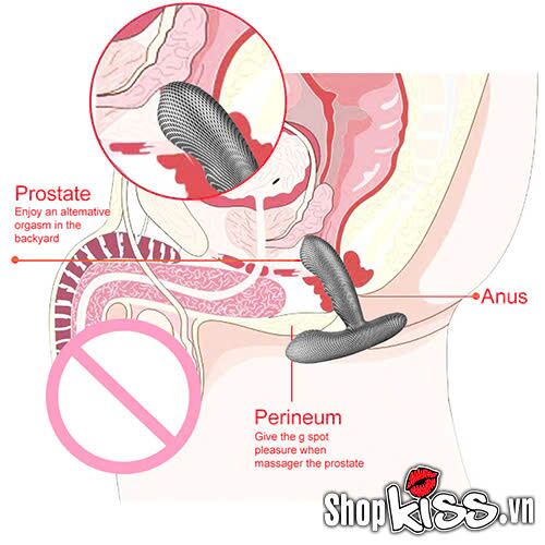  Giá sỉ Dụng cụ kích thích hậu môn kiểu sọc sợi carbon Levett nhập khẩu