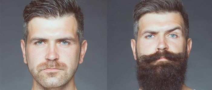 Minoxidil 5% Dạng Bọt Tăng Mọc Râu Mạnh Mẽ, Hiệu Quả