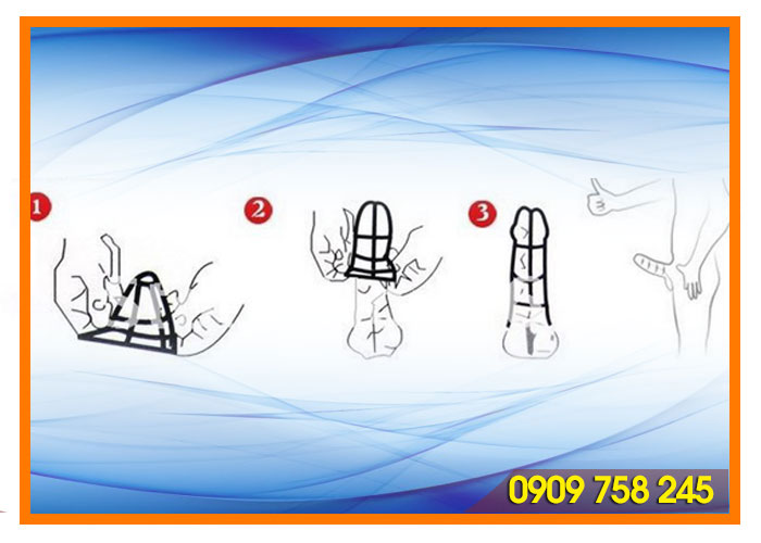 Bao cao su đôn dên vòng gân SHP175 độc đáo tăng khoái cảm