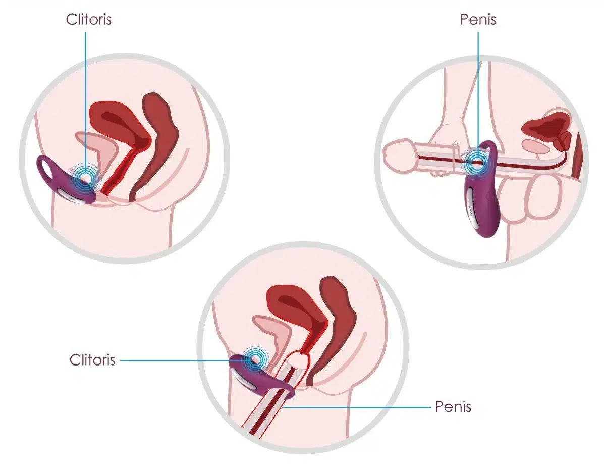 Vòng rung Svakom Wini điều khiển từ xa gai mềm kích thích cực khoái