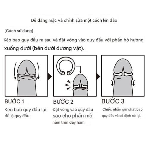 Vòng đeo đầu khấc nong bao quy đầu My Peace Nhật Bản chính hãng