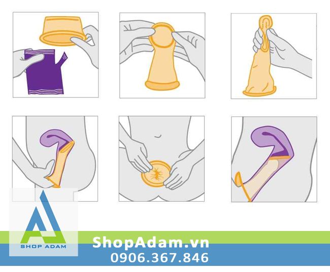 So sánh Bao cao su dành cho phụ nữ - Female Condom hàng mới về So sánh Bao cao su dành cho phụ nữ - Female Condom hàng mới về